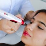 Épilation laser